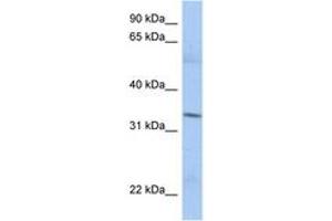 Image no. 1 for anti-Mitochondrial Ribosomal Protein L15 (MRPL15) (AA 35-84) antibody (ABIN6743415)