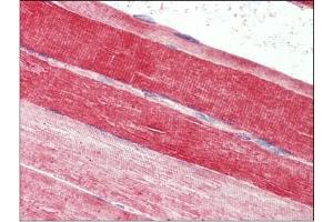 Skeletal muscle, Human: Formalin-Fixed, Paraffin-Embedded (FFPE) (FABP7 Antikörper  (C-Term))