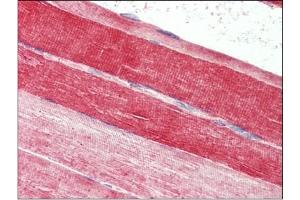 Skeletal muscle, Human: Formalin-Fixed, Paraffin-Embedded (FFPE)