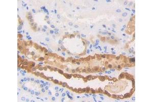 Used in DAB staining on fromalin fixed paraffin- embedded Kidney tissue (HSPA6 Antikörper  (AA 1-387))