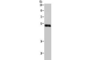 Gel: 8 % SDS-PAGE, Lysate: 40 μg, Lane: Human placenta tissue, Primary antibody: ABIN7192677(STK26 Antibody) at dilution 1/400, Secondary antibody: Goat anti rabbit IgG at 1/8000 dilution, Exposure time: 5 minutes (STK26/MST4 Antikörper)