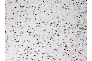 Immunohistochemistry (IHC) image for anti-Proteasome Subunit Alpha Type 3 (PSMA3) (AA 88-127), (Middle Region) antibody (ABIN4886706)