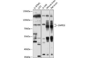 Western blot analysis of extracts of various cell lines, using SMPD3 antibody (ABIN6128775, ABIN6148146, ABIN6148147 and ABIN6214354) at 1:1000 dilution. (SMPD3 Antikörper  (AA 416-655))