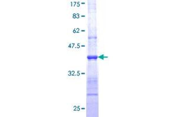 NOS1 Protein (AA 1041-1150) (GST tag)