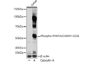 Western blot analysis of extracts of Jurkat cells, using Phospho-PRMT4/C-S228 antibody (ABIN3020120, ABIN3020121, ABIN3020122 and ABIN1681432) at 1:1000 dilution. (CARM1 Antikörper  (pSer228))