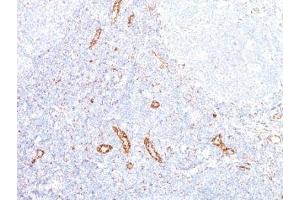 Formalin-fixed, paraffin-embedded human tonsil stained with VEGF antibody (VEGF/1063). (VEGFA Antikörper)