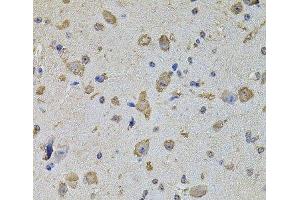 Immunohistochemistry of paraffin-embedded Mouse brain using EIF4A2 Polyclonal Antibody at dilution of 1:100 (40x lens). (EIF4A2 Antikörper)