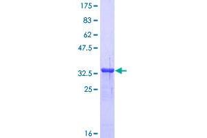 Image no. 1 for Metallothionein 1A (MT1A) (AA 1-61) protein (GST tag) (ABIN1311495) (MT1A Protein (AA 1-61) (GST tag))