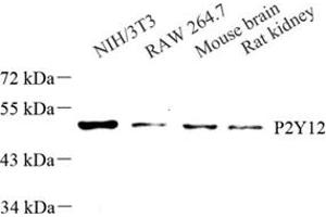 P2RY12 Antikörper