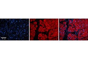 Rabbit Anti-Tnks Antibody  Catalog Number: ARP33978_P050 Formalin Fixed Paraffin Embedded Tissue: Human Adult heart  Observed Staining: Cytoplasmic Primary Antibody Concentration: 1:600 Secondary Antibody: Donkey anti-Rabbit-Cy2/3 Secondary Antibody Concentration: 1:200 Magnification: 20X Exposure Time: 0. (TNKS Antikörper  (Middle Region))