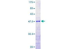 Image no. 1 for Reticulon 1 (RTN1) (AA 1-208) protein (GST tag) (ABIN1318960) (Reticulon 1 Protein (RTN1) (AA 1-208) (GST tag))