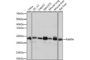 RAB9A Antikörper