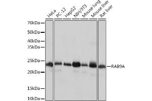 Western blot analysis of extracts of various cell lines, using RA Rabbit mAb (ABIN7269817) at 1:1000 dilution. (RAB9A Antikörper)