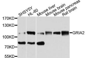 Western blot analysis of extracts of various cells, using MET antibody. (c-MET Antikörper)