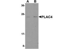 Western blot analysis of PLAC4 in human placenta tissue lysate with PLAC4 antibody at (A) 1 and (B) 2 μg/ml. (PLAC4 Antikörper  (Center))