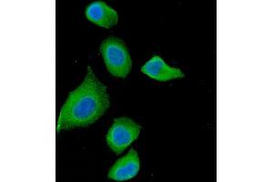 IF analysis of DAB2 using anti-DAB2 antibody (ABIN7602613). (DAB2 Antikörper  (AA 89-770))