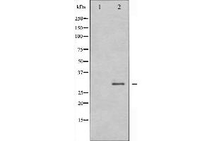 Western blot analysis of RFA2 expression in K562 whole cell lysates,The lane on the left is treated with the antigen-specific peptide. (RPA2 Antikörper  (N-Term))