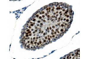 IHC analysis of PTBP2 using anti-PTBP2 antibody (ABIN7599453).