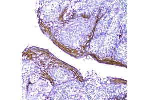 IHC analysis of Periplakin using anti-Periplakin antibody (ABIN5518787). (PPL Antikörper  (C-Term))