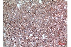 Immunohistochemistry (IHC) analysis of paraffin-embedded Human Liver, antibody was diluted at 1:100.