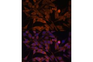 Immunofluorescence analysis of HeLa cells using CACYBP antibody  at dilution of 1:100. (CACYBP Antikörper  (AA 1-228))