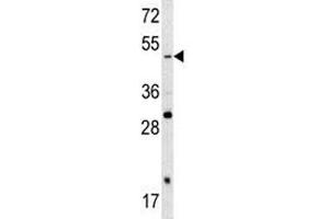 Western blot analysis of SOX4 antibody and A2058 lysate. (SOX4 Antikörper  (AA 86-114))