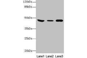 Western Blot All lanes: B4GALT5 antibody at 8 μg/mL Lane 1: Mouse heart tissue Lane 2: Mouse liver tissue Lane 3: Mouse brain tissue Secondary Goat polyclonal to rabbit IgG at 1/10000 dilution Predicted band size: 46 kDa Observed band size: 46 kDa (B4GALT5 Antikörper  (AA 101-388))