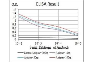 Black line: Control Antigen (100 ng), Purple line: Antigen(10 ng), Blue line: Antigen (50 ng), Red line: Antigen (100 ng), (L-Selectin Antikörper  (AA 83-186))