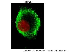 Sample Type: hRetinal pigment epithelial cellsGreen: primaryRed: nuclearPrimary Dilution: 1:200Secondary Antibody: goat anti-rabbit-Alexa 488Secondary Dilution: 1:500Image Submitted by: Brian KennedyIndiana University Northwest . (TRPV5 Antikörper  (N-Term))