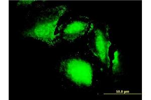 Immunofluorescence of monoclonal antibody to ERN1 on HeLa cell. (ERN1 Antikörper  (AA 401-500))