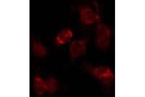 ABIN6276287 staining Hepg2 by IF/ICC. (alpha Fetoprotein Antikörper  (C-Term))