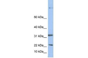 Selenoprotein antibody used at 1 ug/ml to detect target protein. (Sep 15 Antikörper  (Middle Region))
