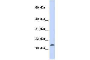 Synuclein Alpha antibody used at 1 ug/ml to detect target protein. (SNCA Antikörper)