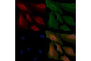 ABIN6264894 and ABIN6266632 staining  cells by IF/ICC. (S100A1 Antikörper  (N-Term))