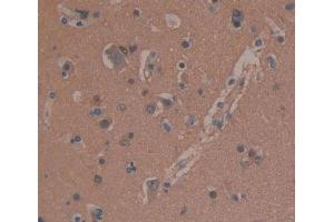 Used in DAB staining on fromalin fixed paraffin- embedded brain tissue (MAP1B Antikörper  (AA 2207-2468))
