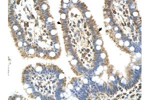 Complement C8b antibody was used for immunohistochemistry at a concentration of 4-8 ug/ml to stain EpitheliaI cells of intestinal villus (arrows) in Human Intestine. (C8B Antikörper  (Middle Region))