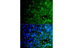 Immunofluorescence analysis of A549 cells using USP10 antibody (ABIN4905568).