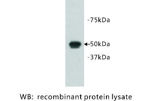 Image no. 1 for anti-FAT Tumor Suppressor Homolog 1 (FAT1) antibody (ABIN1112925) (FAT1 Antikörper)