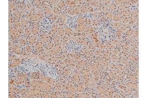Immunohistochemistry (IHC) image for anti-LIM Domain Kinase 1 (LIMK1) (pThr508) antibody (ABIN6255701)