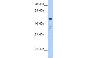 WB Suggested Anti-SLC35F5 Antibody Titration:  2. (SLC35F5 Antikörper  (C-Term))