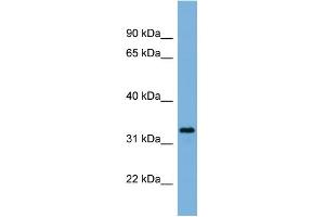 WB Suggested Anti-PEX11A Antibody Titration:  0.
