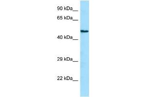WB Suggested Anti-ANGPTL1 Antibody Titration: 1. (ANGPTL1 Antikörper  (N-Term))