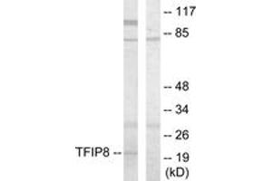 Western blot analysis of extracts from HuvEc cells, using TFIP8 Antibody. (Cytokeratin 5 Antikörper  (AA 31-80))