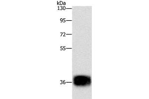 Western Blot analysis of Mouse heart tissue using CEBP epsilon Polyclonal Antibody at dilution of 1:500 (CEBPE Antikörper)