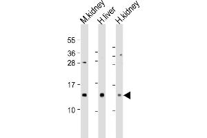 All lanes : Anti-MTCP1 Antibody (C-Term) at 1:2000 dilution Lane 1: mouse kidney lysates Lane 2: human liver lysates Lane 3: human kidney lysates Lysates/proteins at 20 μg per lane. (MTCP1 Antikörper  (AA 73-103))