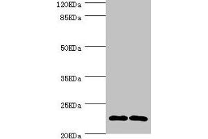 Western blot All lanes: CMPK1 antibody at 3. (Cytidine Monophosphate (UMP-CMP) Kinase 1, Cytosolic (CMPK1) (AA 37-196) Antikörper)