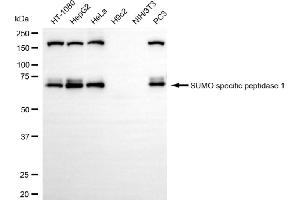 Western blotting analysis using SUMO specific peptidase 1 antibody (ABIN7800975). (Rekombinanter SUMO Specific Peptidase 1 Antikörper)