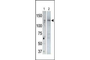 The anti-USP25 C-term Pab (ABIN388918 and ABIN2839197) is used in Western blot to detect USP25 in rat testis tissue lysate (lane 1) and USP25-transfected HeLa cell lysates (lane 2).