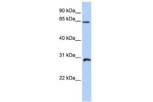 Western Blot showing HOXA5 antibody used at a concentration of 1. (HOXA5 Antikörper  (C-Term))