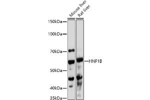 Western blot analysis of extracts of various cell lines, using HNF1B antibody (ABIN3017358, ABIN3017359, ABIN3017360, ABIN1680315 and ABIN1680316) at 1:1000 dilution. (HNF1B Antikörper  (AA 100-200))